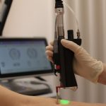 Laser Hair Removal
