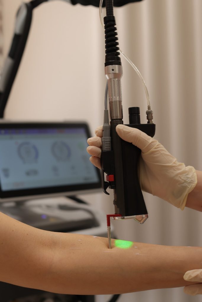 Laser Hair Removal