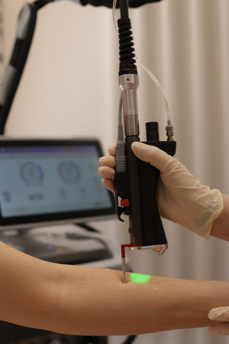 Laser Hair Removal