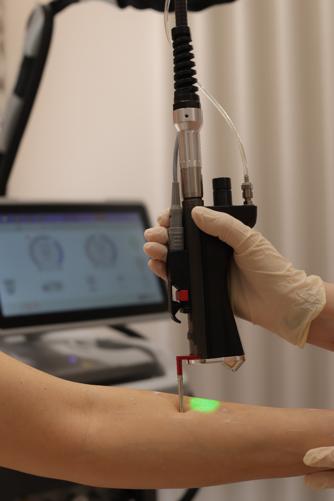Laser Hair Removal