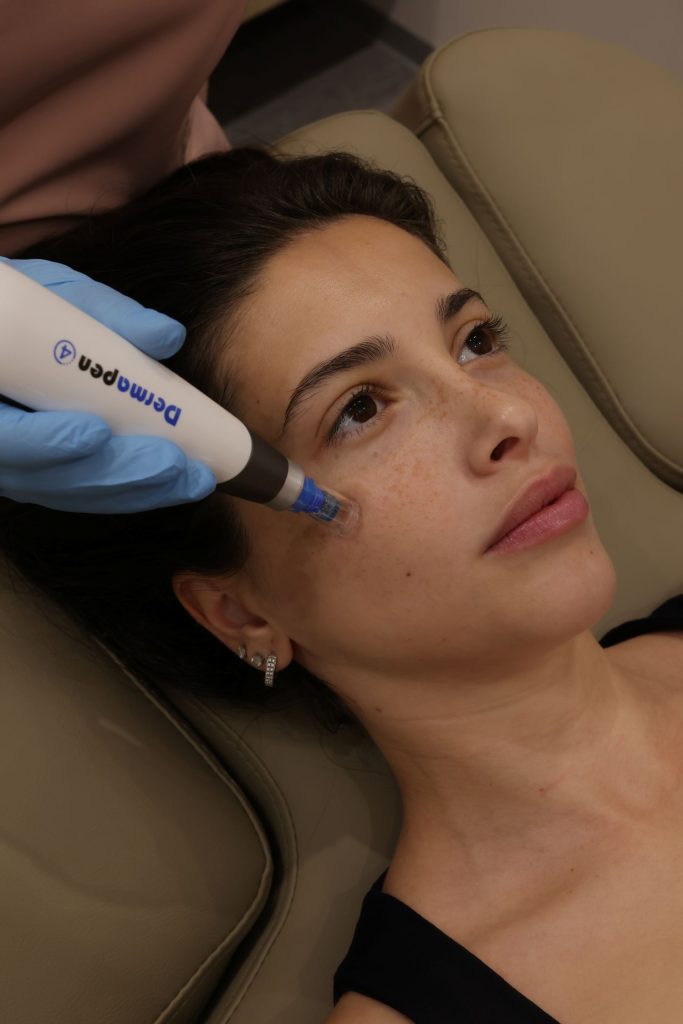 dermapen 4 microneedling tirana albania